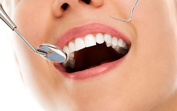 Contornatura e rimodellamento dentale