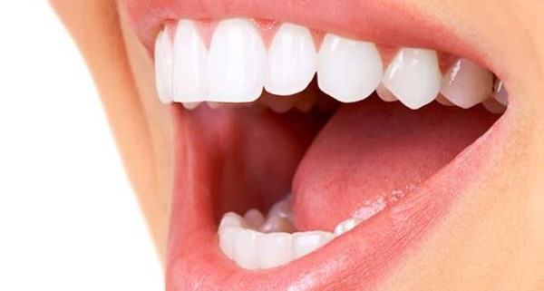 denti corti o piccoli microdonzia