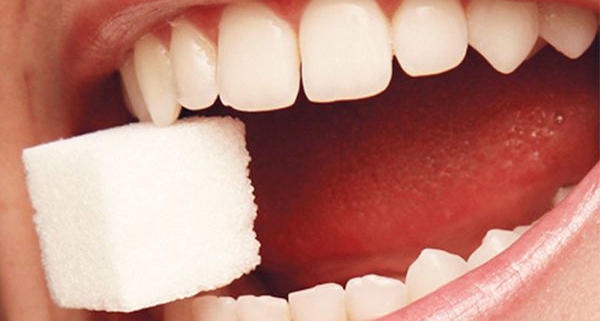 Decalcificazione dei denti