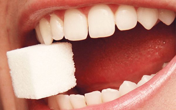Decalcificazione dei denti