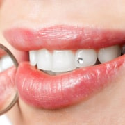 Puoi usare i brillantini senza danneggiare i tuoi denti?
