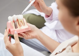L’implantologia dentale è dolorosa? Cannizzo Studio Milano