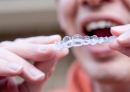 5 miti da sfatare sui trattamenti ortodontici