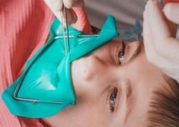 La diga di gomma è uno strumento utilizzato in odontoiatria per isolare uno o più denti durante un intervento dentale. Cannizzo Studio Milano.