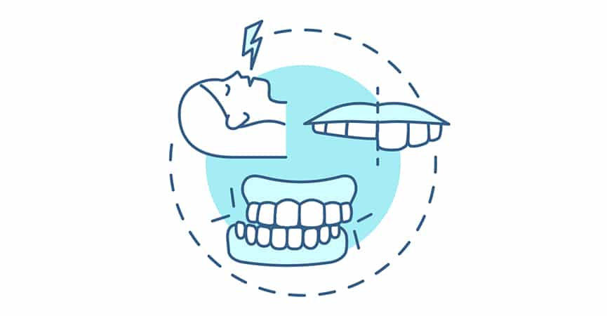 Come evitare di digrignare i denti di notte: consigli utili