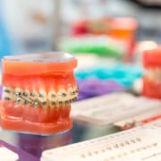 Ortodonzia e il rapporto tra dentatura e postura corporea