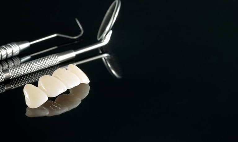 Ci sono diverse opzioni disponibili per la sostituzione dei denti. Ogni opzione ha i suoi vantaggi e svantaggi. Cannizzo Studio