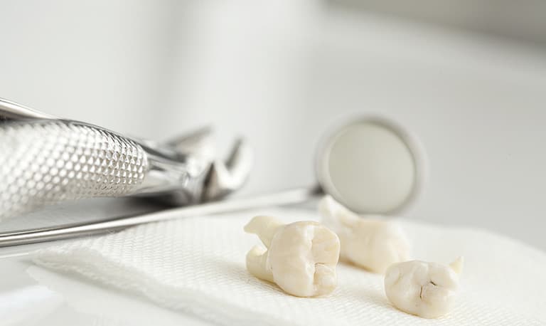 Il processo di "stripping dentale" è diventato sempre più popolare nel mondo dell'odontoiatria e dell'ortodonzia.
