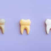 Con la correzione del colore dei denti sempre più persone cercano modi per ottenere un sorriso perfetto e privo di macchie.