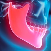 Osso mandibolare e implantologia