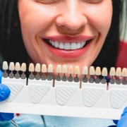 Ceramica o disilicato di litio: scelta del materiale per faccette dentali