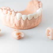 Come le capsule dentali possono trasformare il tuo sorriso