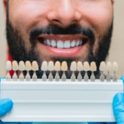 Dal bianco perlato al giallo: fattori che influenzano il colore dei denti