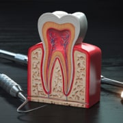Ipersensibilità dentinale: cause, sintomi e cure efficaci