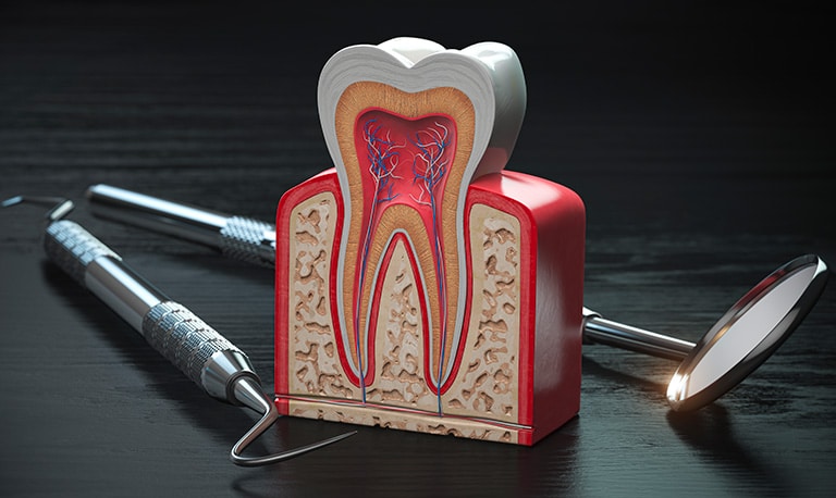 Ipersensibilità dentinale: cause, sintomi e cure efficaci