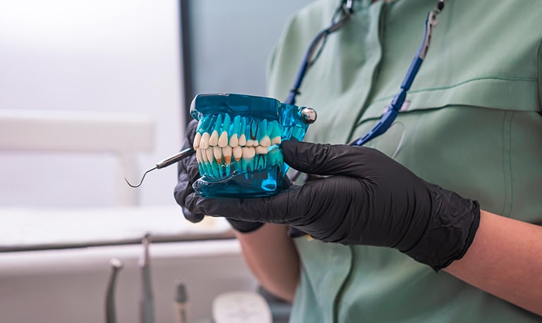 Protesi dentarie: differenze tra scheletrato dentale e dentiera